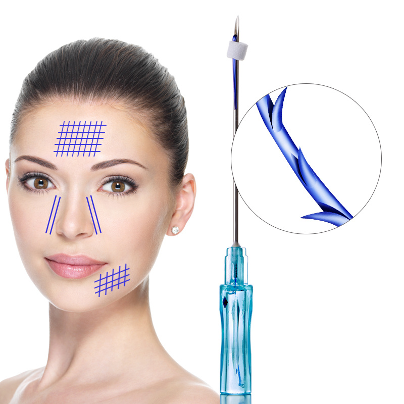 Best Sale Amazing Noninvasive Lifting Cog 3D 4D Pdo Thread Lift