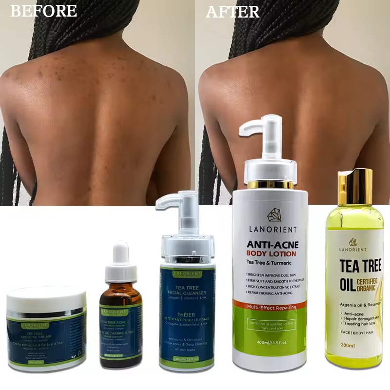 Lanorient The Latest Natural Organic Tea Tree Korean Skin Care Product Vitamin C Acne Removal Skin Care Set For All Skin Types
