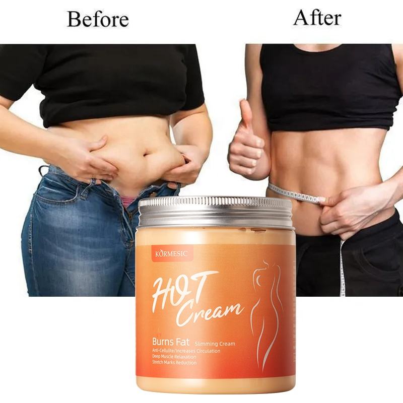 Oem Kormesic Private Label Slim Cream Weight Loss Fat Burning Slimming Gel Hot Cream Massage Body Cellulite Arm Slimming Cream