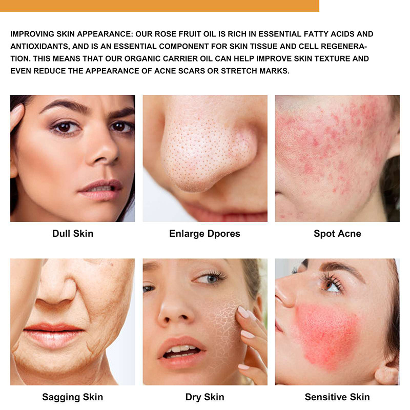 OEM ODM Hot Sale Wholesale Facial Skin Care Essence Improved Vitamin Retinol Oil Anti Dark Pots Anti Aging 100%Nature Essential