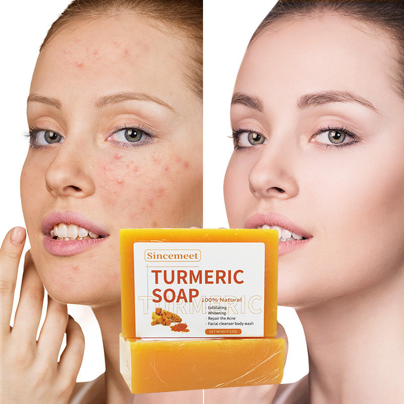 Soaps Manufacturing Toilet Soap Anti Acne Dark Spots Removal Natural Organic Handmade Ginger Turmeric Soap Bar Liquid