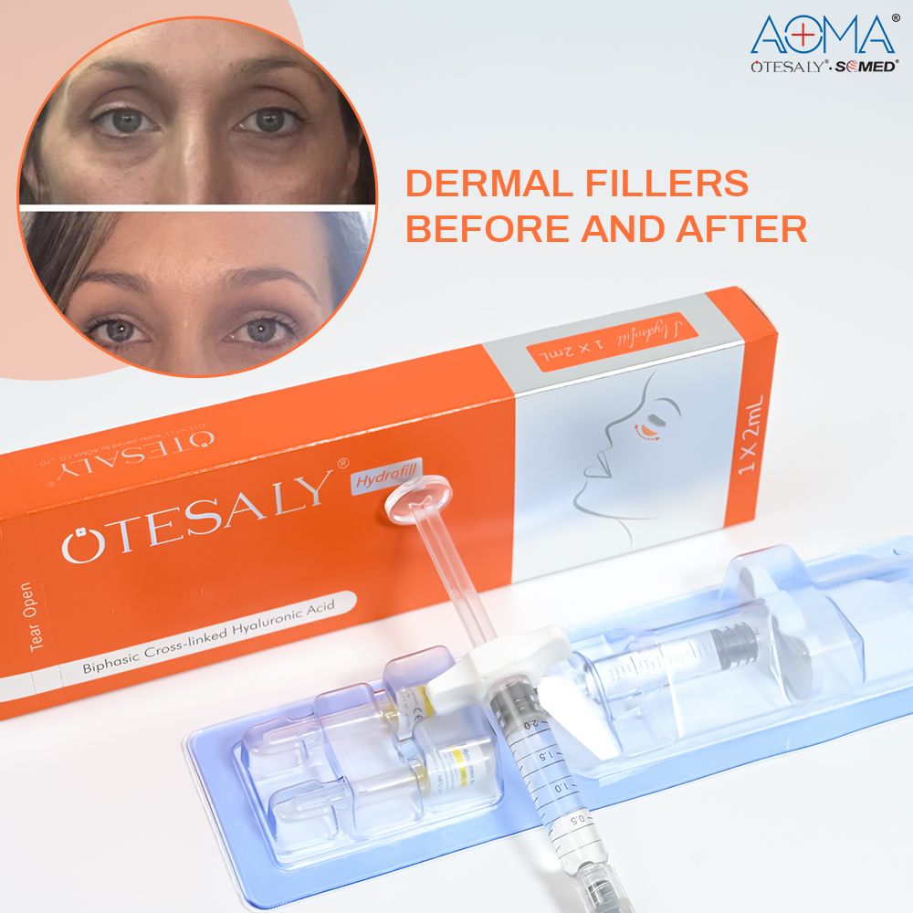 Factory Wholesale Aoma Otesaly Vital 2ml Skin Booster Solution