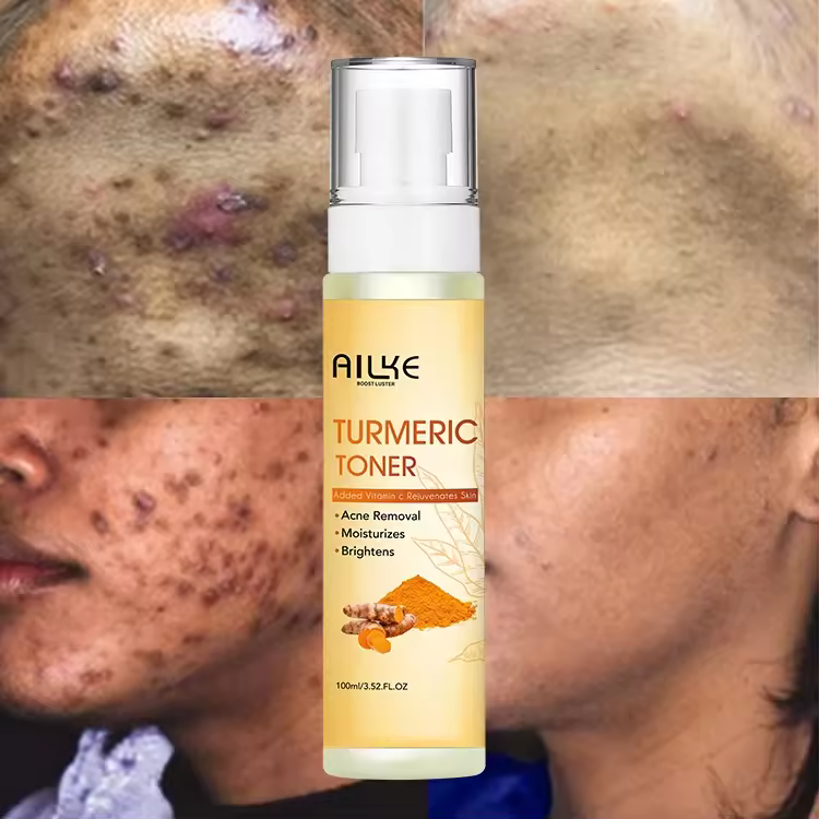 Wholesale Tumeric Toner Dark Spot Brightening Fades Blemishes Witch Hazel Black Skin Care Face Vitamin C Skin Toner