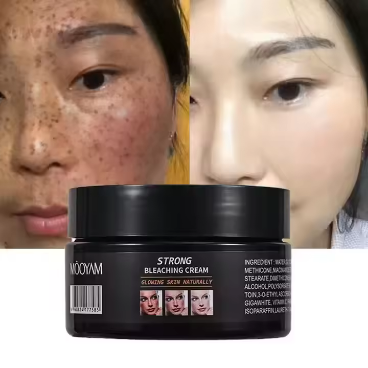 Best Sale 120g Powerful Whitening Freckle Face Cream Remove Melasma Acne Spots Pigment Melanin Dark Spots Strong Bleaching Cream